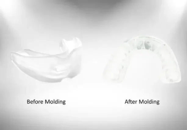 Anti-Snoring Mouthpiece